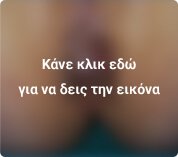 Θρόμβωση αιμορροΐδων