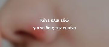έρπης μύτη 2