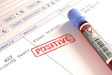 hiv positive