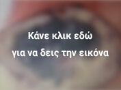 εξαίρεση σε υγιή όρια