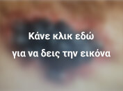 μελάνωμα ραχης