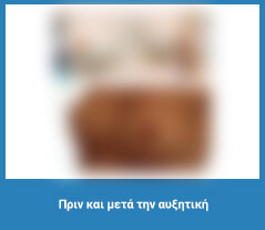 Πλαστική στήθους