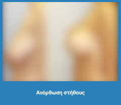 Πλαστική στήθους