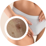 Γεννητικά όργανα