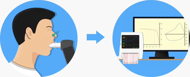χαπ σπιρομέτρηση