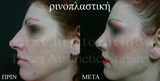 video thumbnail (4)