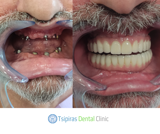 video thumbnail (11)