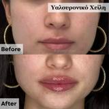 video thumbnail (14)