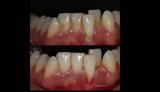 video thumbnail (2)