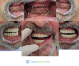 video thumbnail (12)