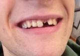 video thumbnail (5)