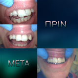 video thumbnail (3)