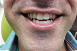 video thumbnail (1)
