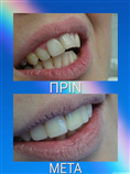 video thumbnail (4)