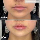 video thumbnail (15)