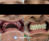 video thumbnail (14)