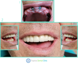 video thumbnail (15)