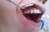 video thumbnail (2)