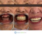 video thumbnail (10)