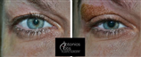 Τότης Αντώνης - Πλαστική Χειρουργική ματιών