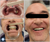 video thumbnail (13)