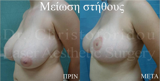 video thumbnail (10)