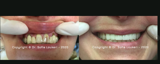 video thumbnail (1)