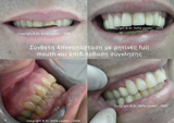 video thumbnail (1)