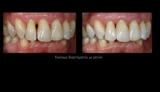video thumbnail (1)