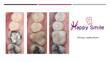 video thumbnail (2)