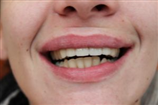 video thumbnail (3)