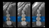 video thumbnail (3)