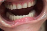 video thumbnail (4)