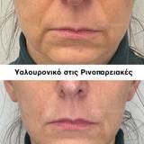 video thumbnail (12)