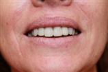 video thumbnail (5)