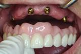 video thumbnail (23)