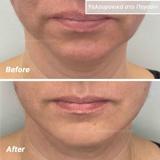 video thumbnail (10)