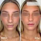 video thumbnail (13)