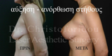 video thumbnail (12)