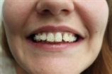 video thumbnail (6)