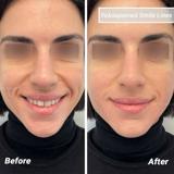 video thumbnail (11)