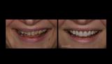 video thumbnail (4)