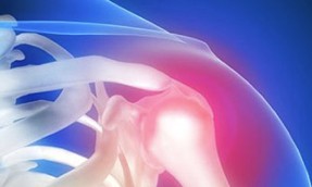 Second Placement Photo