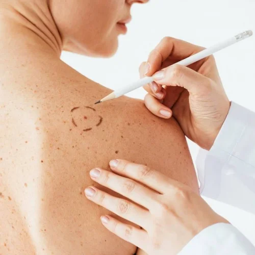 Μαρία Κορνελάκη Dermatologist - Venereologist: Book an online appointment