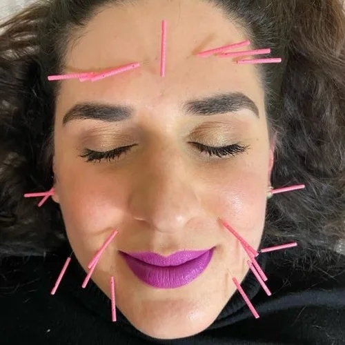 Σαπαλίδου Κυριακή Βελονιστής | doctoranytime