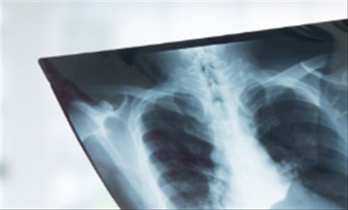 Περαντώνη Ελένη Πνευμονολόγος - Φυματιολόγος | doctoranytime