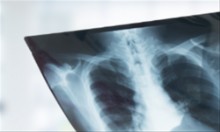 Περαντώνη Ελένη Πνευμονολόγος - Φυματιολόγος | doctoranytime